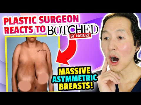 Video: Asymmetric Breasts, Lips And Other Star Plastics