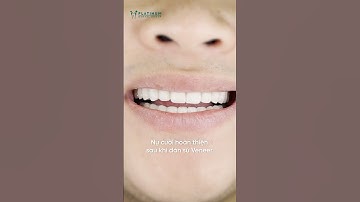 Loại bỏ răng xỉn màu, nhiễm Tetra - Tái sinh nụ cười #veneers