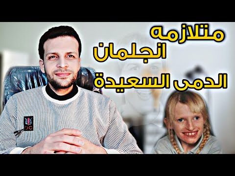 متلازمه انجلمان | متلازمه الدمى السعيدة | اسباب | تشخيص | اعراض | علاج angelman syndrome