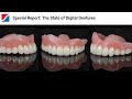 Special Report: The State of Digital Dentures