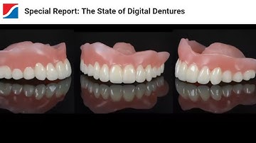 Special Report: The State of Digital Dentures