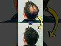 Replace hair loss in photoshop photoediting photoshop