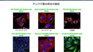 免疫蛍光染色の基礎：第2回 実験計画の策定