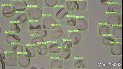 Machine learning approach of automatic identification and counting of blood cells #YOLO