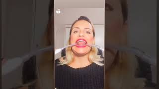 Electro-phonotherapy and anatomical precision - Fonovim Neurological Speech Therapy