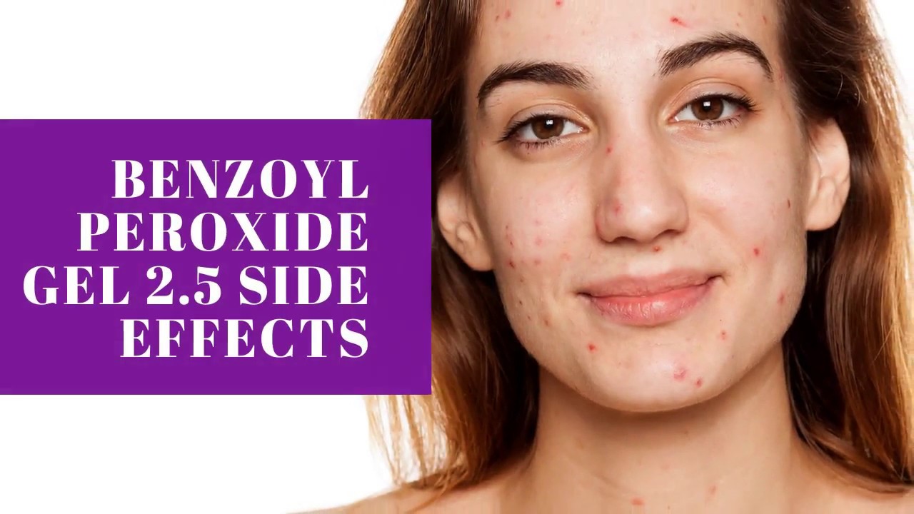 BENZOYL PEROXIDE GEL 2 5 SIDE EFFECTS YouTube