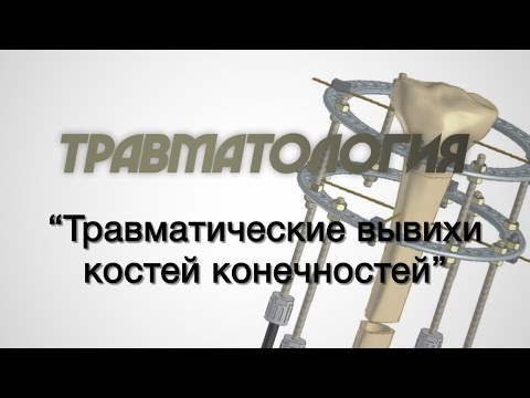 Травматология №2 "Травматические вывихи костей конечностей"