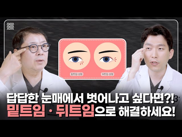 이런 분들은 밑트임·뒤트임 하기 전에 꼭 보셔야 합니다! 답답한 눈매는 이제 그만~ 밑트임, 뒤트임 1편_[4월31일 성형외과]
