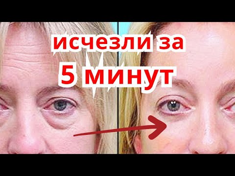 Морщины Вокруг Глаз Исчезнут За 5 минут! Маска от Морщин Отёков Кругов