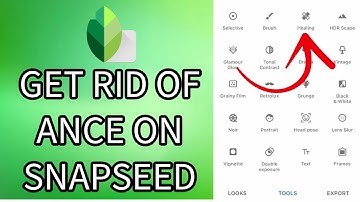 How to Get Rid of Acne on Snapseed 2024?