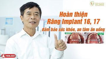 Trồng răng implant 2 răng hàm liền nhau có được không? - KH N.Văn Chế