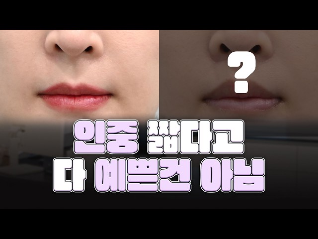 왜 어떤 얼굴은 짧은 인중이 안 어울릴까?