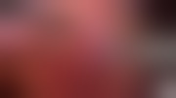 Right Laparoscopic Simple Nephrectomy - by Dr Praveen Pandey