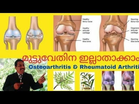 Video: Mafuta Ya Samaki Kwa Paka Na Arthritis