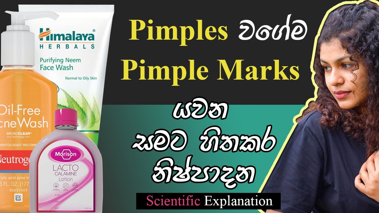 skin-friendly-products-for-get-rid-from-acne-sinhala-review