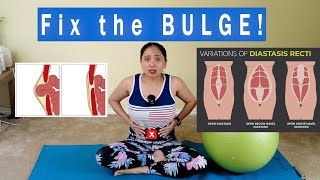5 BEST Ways And Exercises to Fix the BULGE for GOOD! Abs Separation due to Hernia Diastasis Recti
