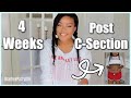 4 WEEKS POST C-SECTION // RECOVERY, BELLY SHOT, WEIGHT LOSS, POOPING, ETC.