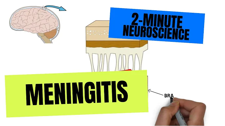 2-Minute Neuroscience: Meningitis