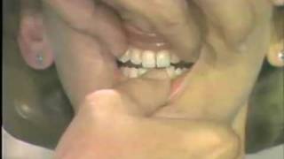 Occlusal Analysis and Examination