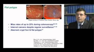 Advanced endoscopic imaging of early GI cancer - Video abstract 58157