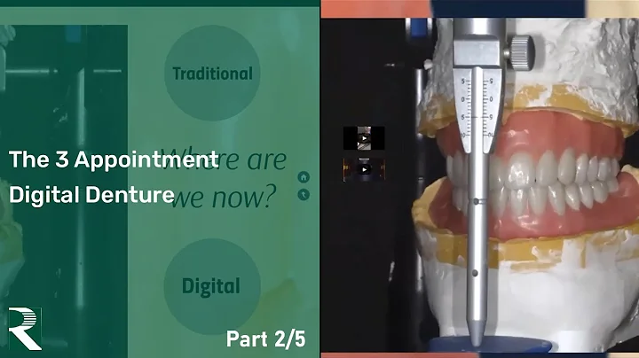 The 3 Appointment Digital Denture Webinar (part 2 of 5)