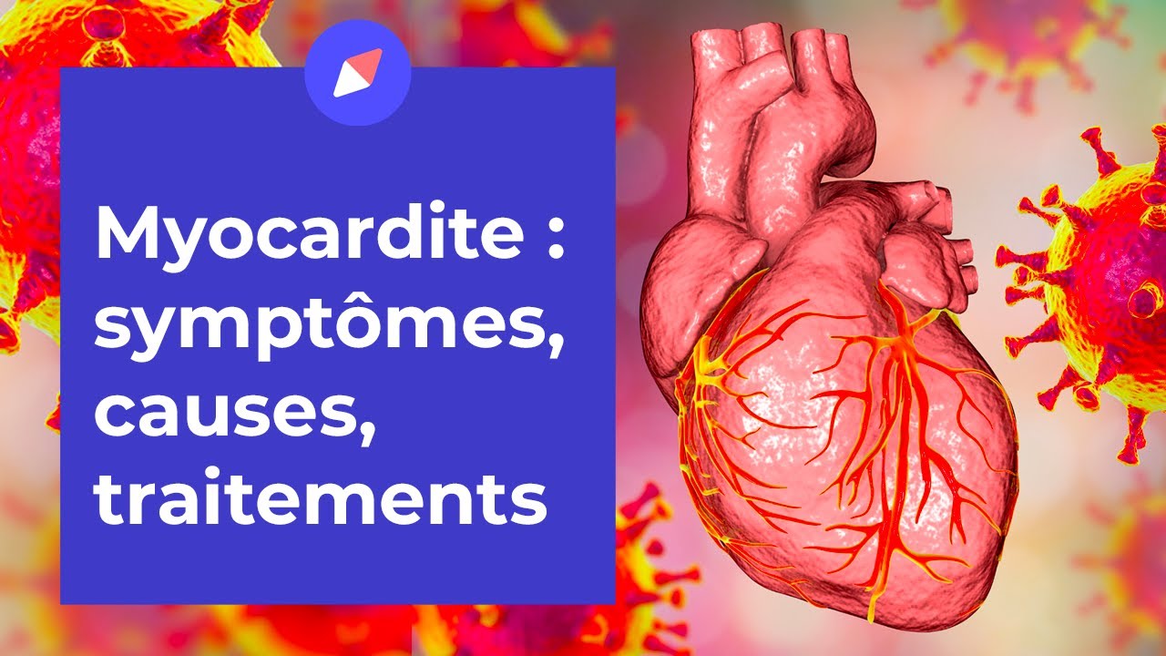 Myocardite : symptômes, causes, traitements