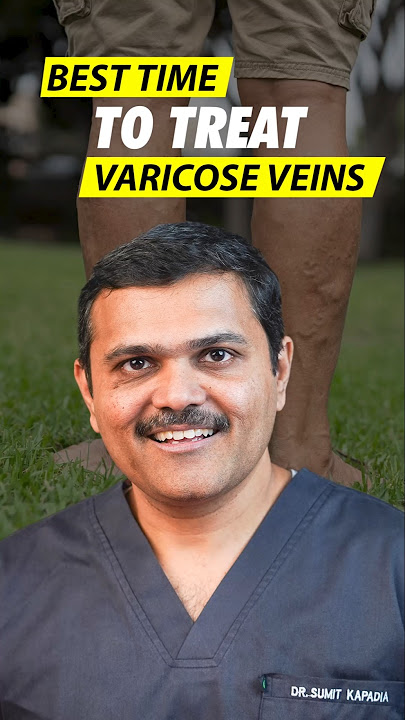 Don't Wait! Best Time to Treat Varicose Veins Explained