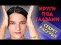 Как избавиться от синяков под глазами? Разбор по фото.