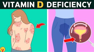 10 Signs Your Body is Crying for Vitamin D | VisitJoy