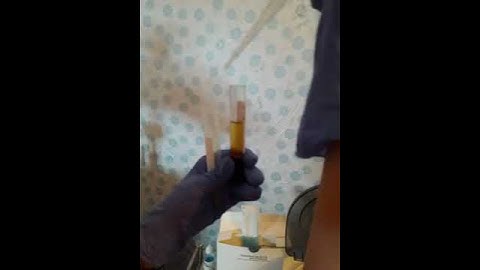 Điều trị da bằng công nghệ PRP bằng tế bào gốc tự thân (Phần 1)