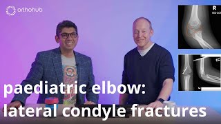 orthohub ODM: paediatric elbows - how to manage lateral condyle fractures – orthopaedic surgeons