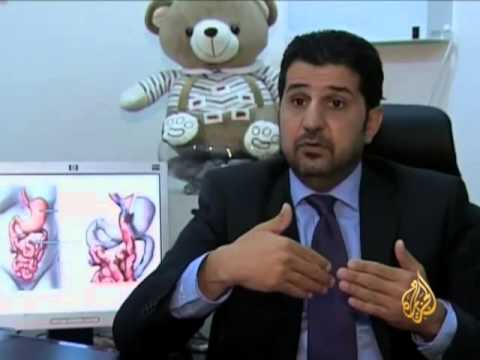 ارتفاع معدلات الإصابة بالسكري في الخليج