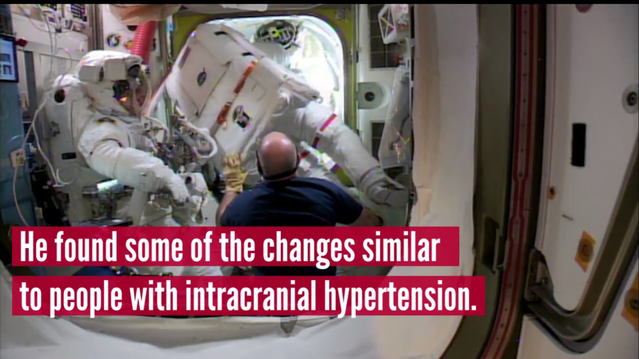 UH Optometrist Investigates Changes in Eye Structure in Astronauts