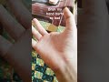 my hand still hurts