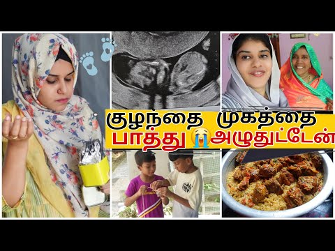 குழந்தை முகத்தை பாத்ததும் 😭அழுகை வந்துருச்சி  ~ 3rd Month Scan Report ~ Pregnancy Cravings 😌 ~ Tamil