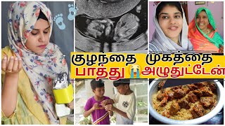 குழந்தை முகத்தை பாத்ததும் 😭அழுகை வந்துருச்சி  ~ 3rd Month Scan Report ~ Pregnancy Cravings 😌 ~ Tamil