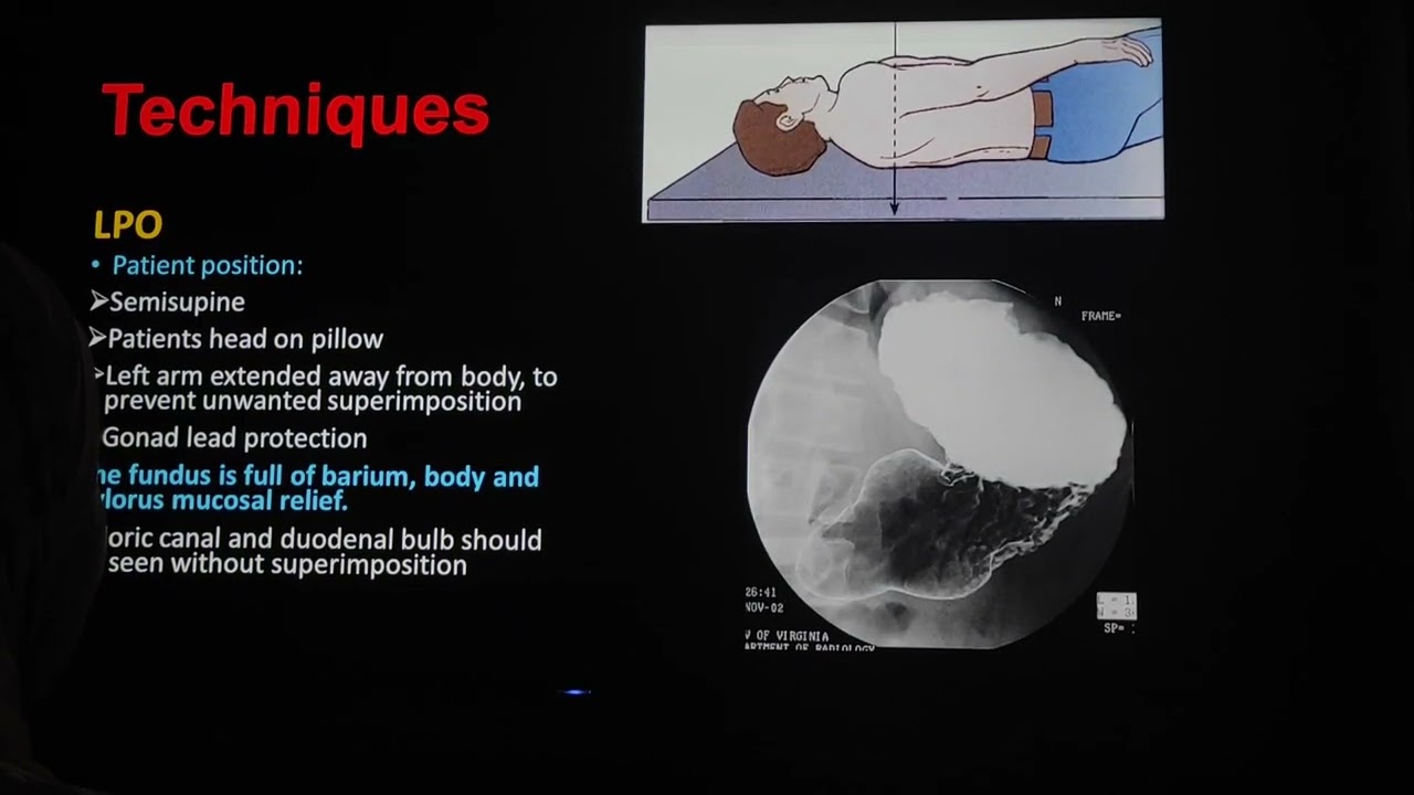 Barium Meal Techniques and imaging Last Part 