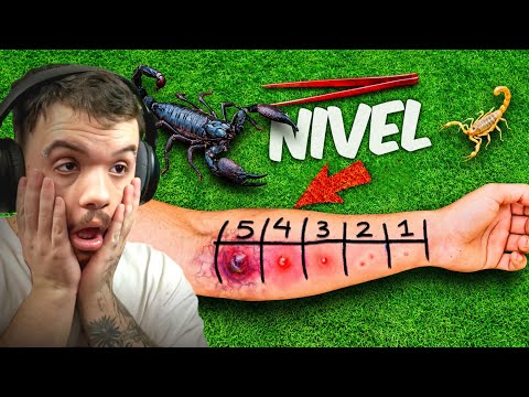 This Guy Got Stung by the Most DANGEROUS Scorpions in the World AT ONCE - Dilane Salvaje React