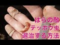 ばらの敵・テッポウ虫（ゴマダラカミキリ）を退治する方法