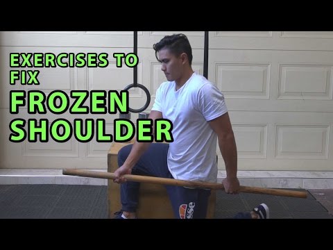 What is a Frozen Shoulder (Animation). 