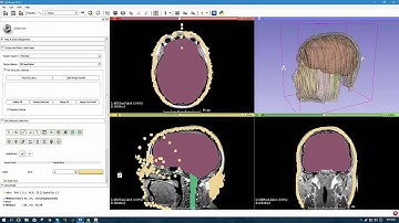 3D Slicer: Assignment 3