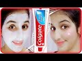 Colgate Face Mask | Colgate For Face || Colgate Face Par Lagane Se Kya Hota Hai | Colgate In Hindi |