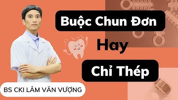 Buộc Chun Đơn Hay Chỉ Thép Khi Chỉnh Nha