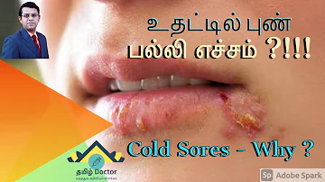 உதட்டில் புண் | பல்லி எச்சம் | Cold Sores - Why ? | தமிழ்