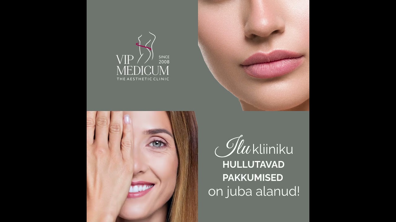 Hullutavad pakkumised on alanud!