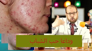 افضل و اسرع علاج لحب الشباب