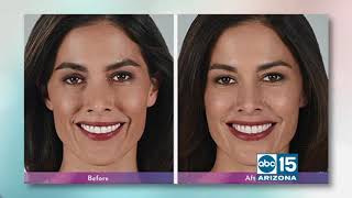 Ultra Smooth Skin can eliminate lines with a range of treatments screenshot 2