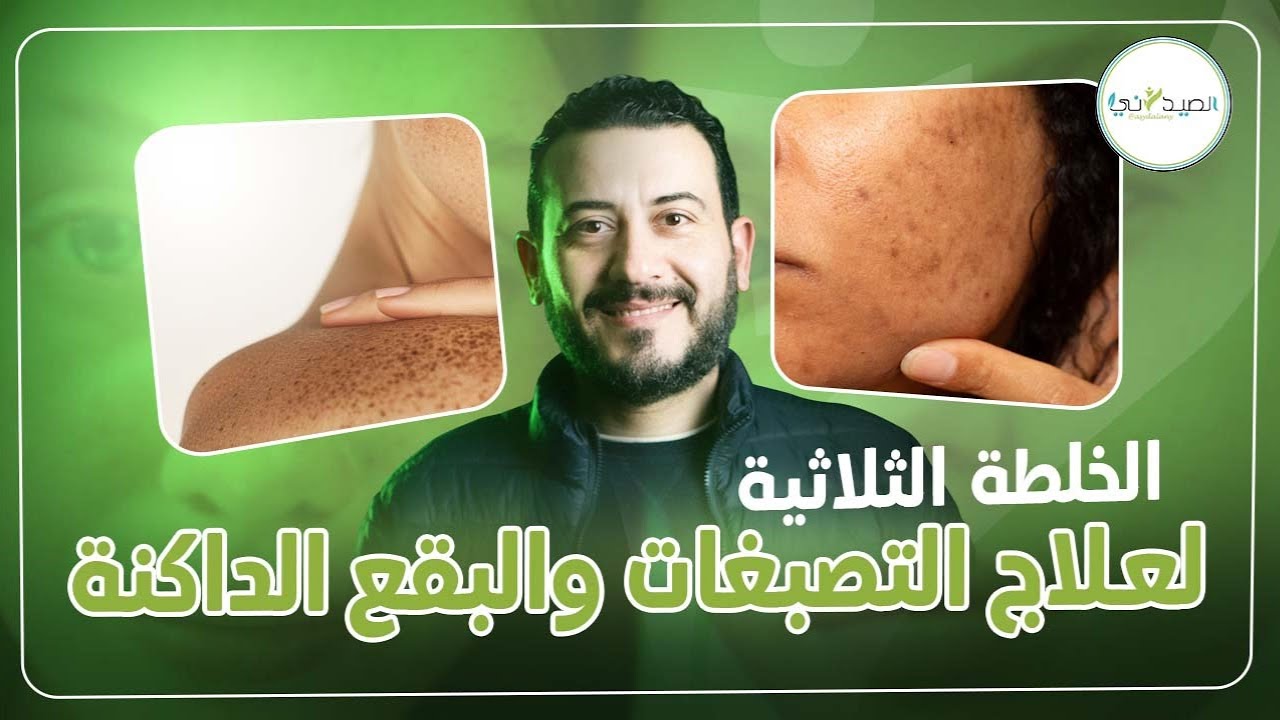 وداعا للبقع والتصبغات القوية بكريم واحد فقط البديل للخلطة الثلاثية