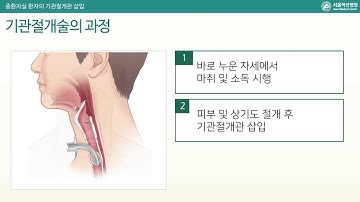 중환자 기관절개관 (Tracheostomy in ICU)