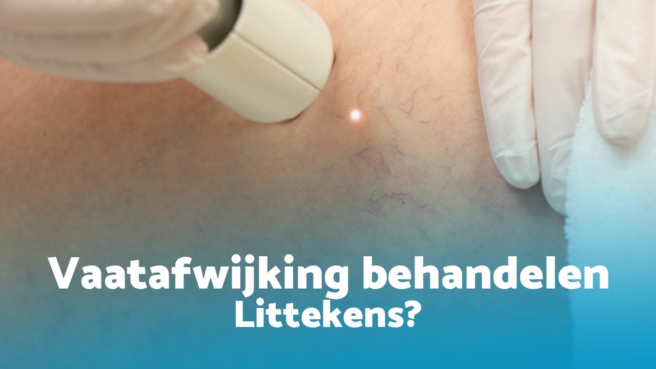 Ontstaan er littekens bij een vaatafwijking behandeling?